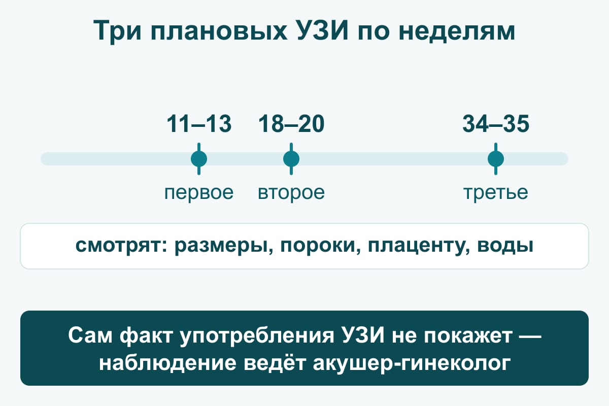 Схема: шкала недель беременности с тремя плановыми УЗИ — 11–13, 18–20 и 34–35 недель; смотрят размеры плода, пороки, плаценту и воды, а сам факт употребления УЗИ не покажет